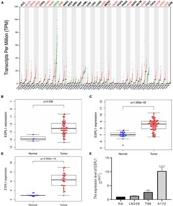 ESPL1 Is a Novel Prognostic Biomarker Associated With the Malignant Features of Glioma